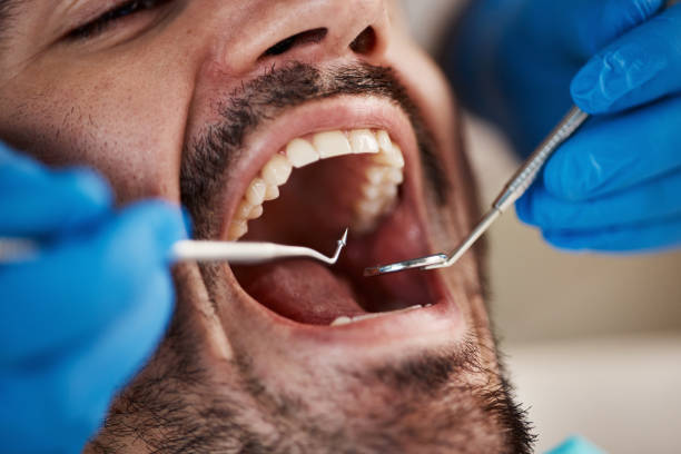 Best Emergency Treatment for Oral Infections in Briarcliff Manor, NY